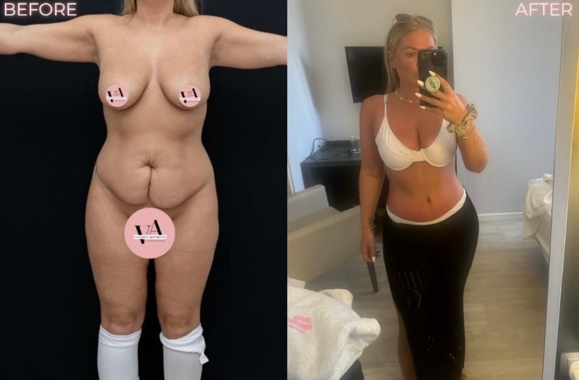 Body