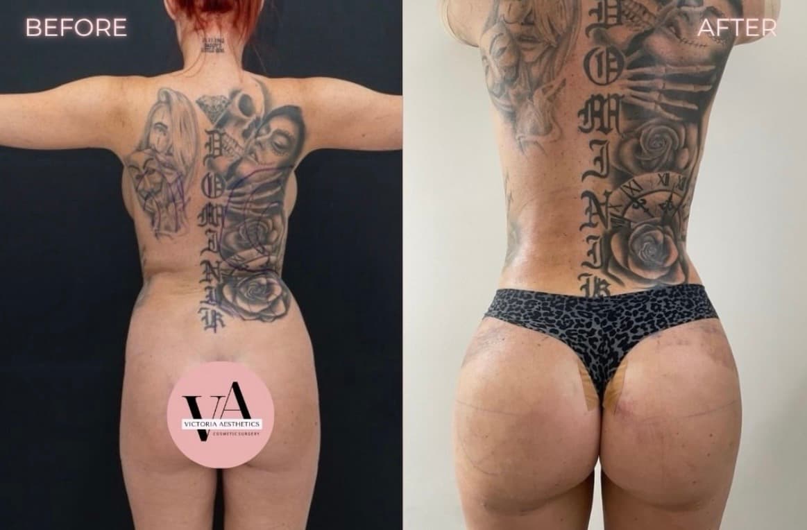 Body