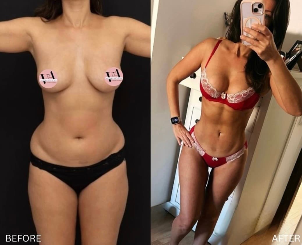 Body