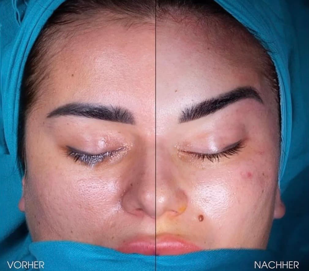 Face